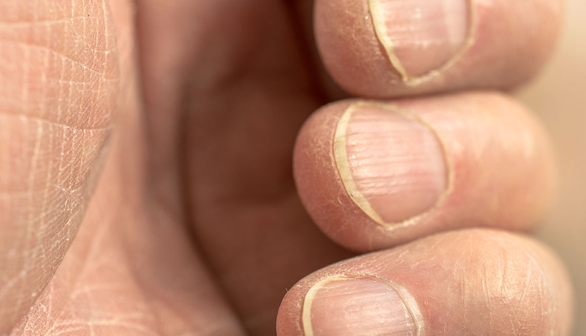 13 Things Your Nails Might Be Telling You About Your Health | The AEDITION