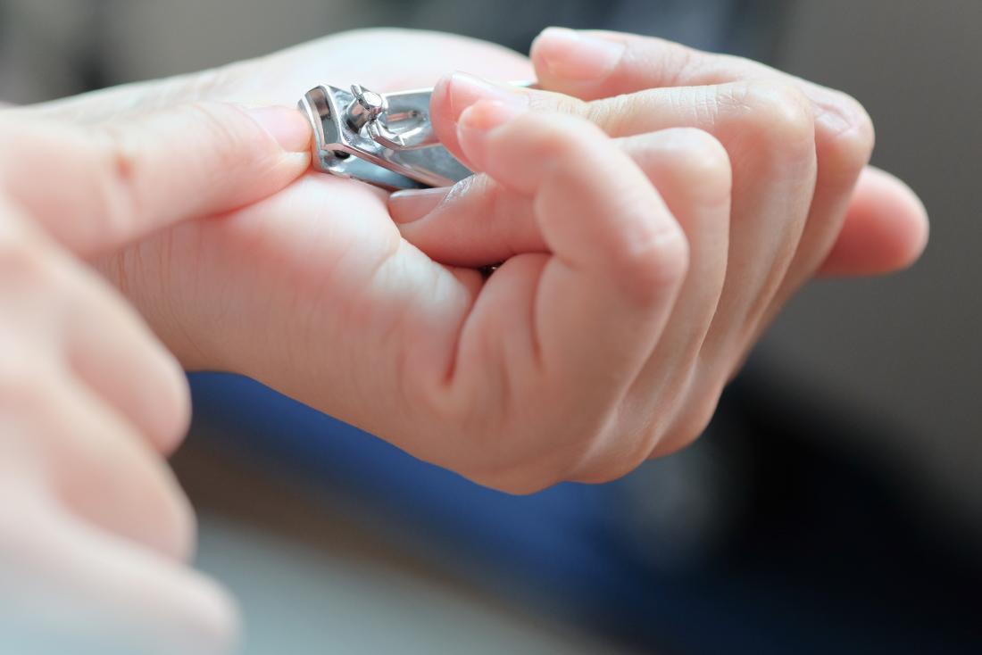 Person with black lines on the nails clipping nails.